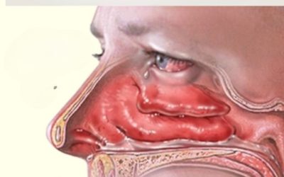 Mucus et Glaires : Remèdes Maison Efficaces