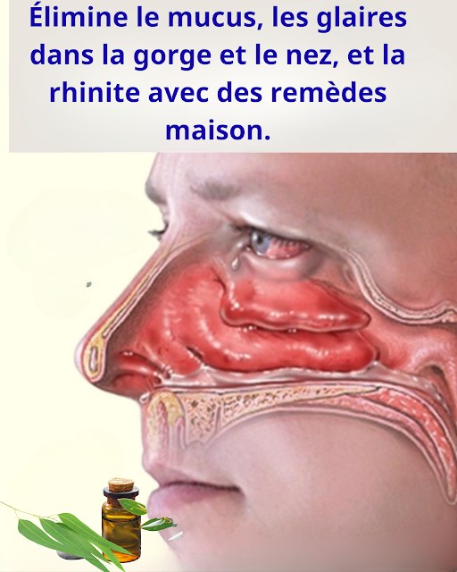 Mucus et Glaires : Remèdes Maison Efficaces