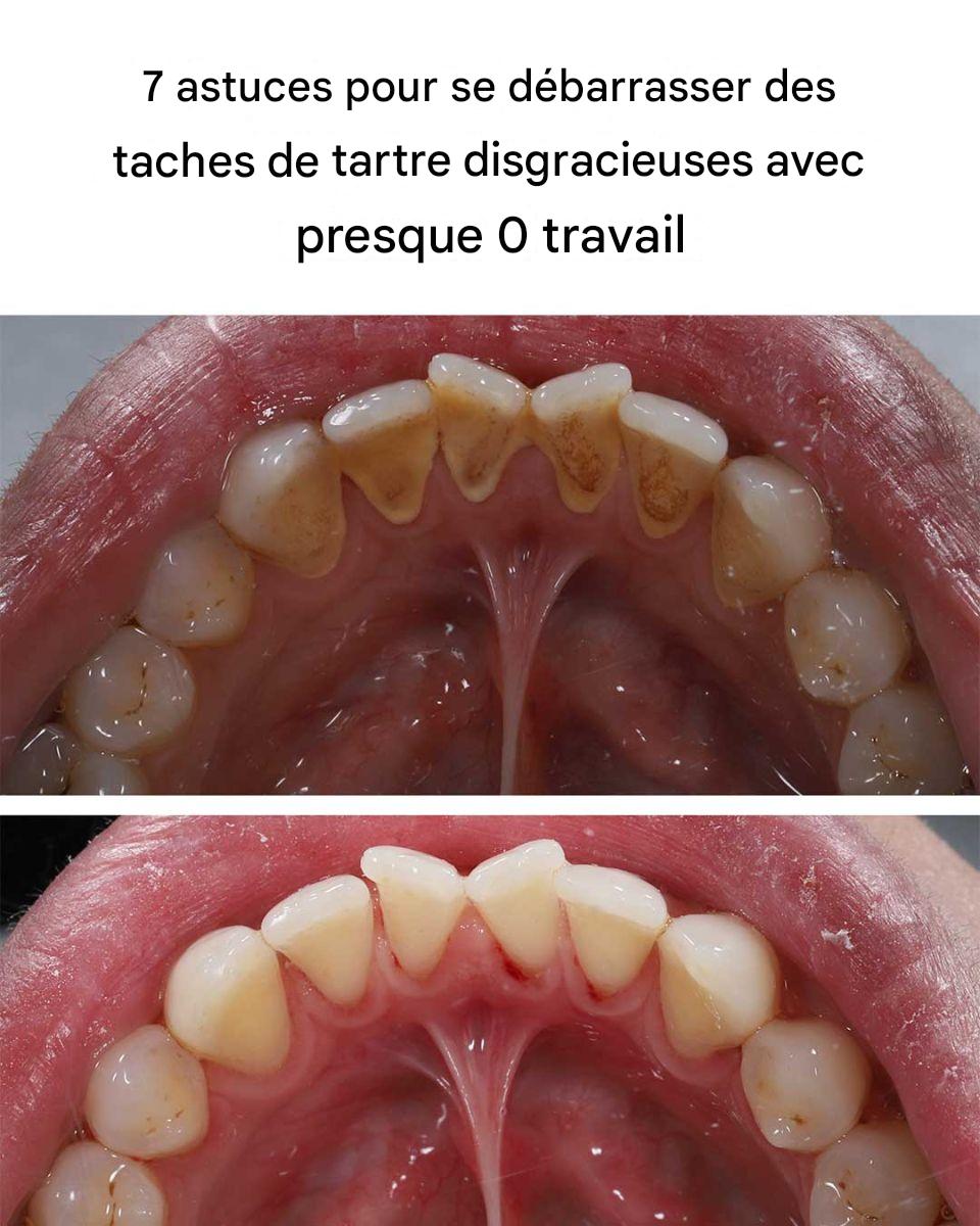 7 astuces pour se débarrasser des taches de tartre disgracieuses avec presque 0 travail.