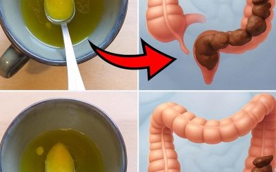 Un remède pour nettoyer le gros intestin