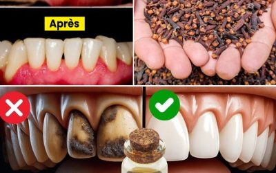 Découvrez le secret de dents plus saines grâce aux bienfaits bucco-dentaires du clou de girofle mâché quotidiennement.