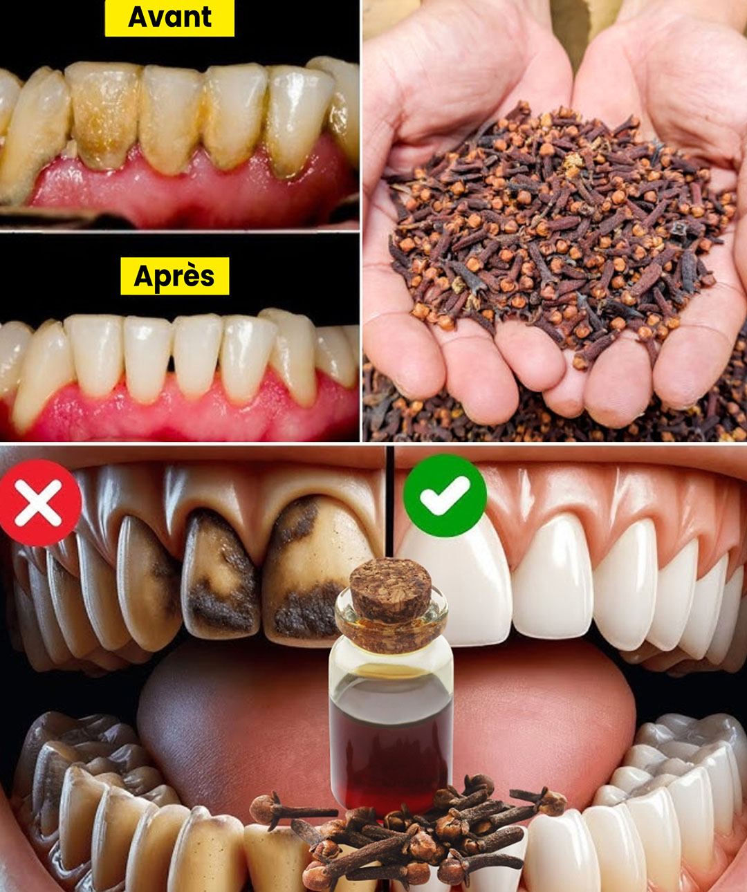 Découvrez le secret de dents plus saines grâce aux bienfaits bucco-dentaires du clou de girofle mâché quotidiennement.