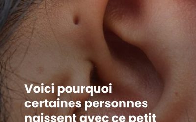 Voici pourquoi certaines personnes naissent avec ce petit trou juste au-dessus de l’oreille ?