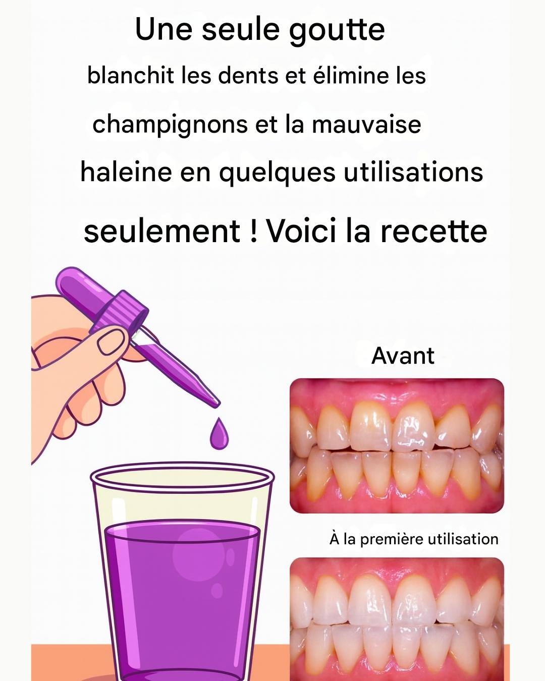 Enlevez le tartre de vos dents et blanchissez-les avec cette recette simple