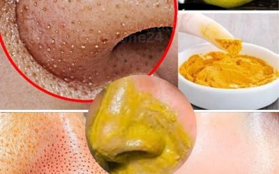 Dites adieu aux points noirs et aux boutons ! Éliminez-les naturellement à la maison… Pour continuer à recevoir mes recettes, il vous suffit de laisser un commentaire… Merci !