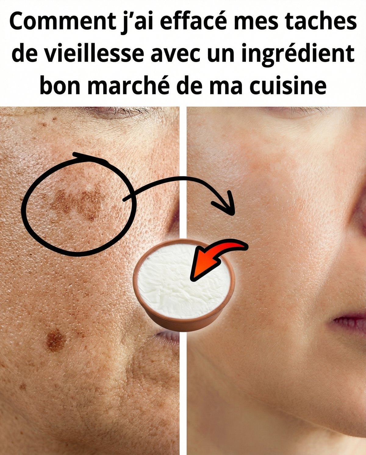 Comment j’ai effacé mes taches de vieillesse avec un ingrédient bon marché de ma cuisine