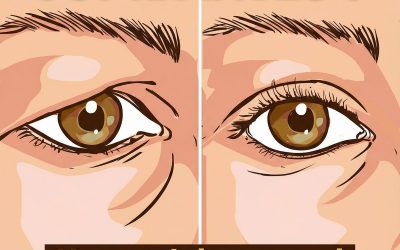 Comment traiter naturellement les paupières tombantes Les résultats sont étonnants !