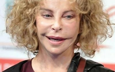 She was once the favorite of millions of people because of her atypical appearance, but she has changed dramatically because of cosmetic surgery
