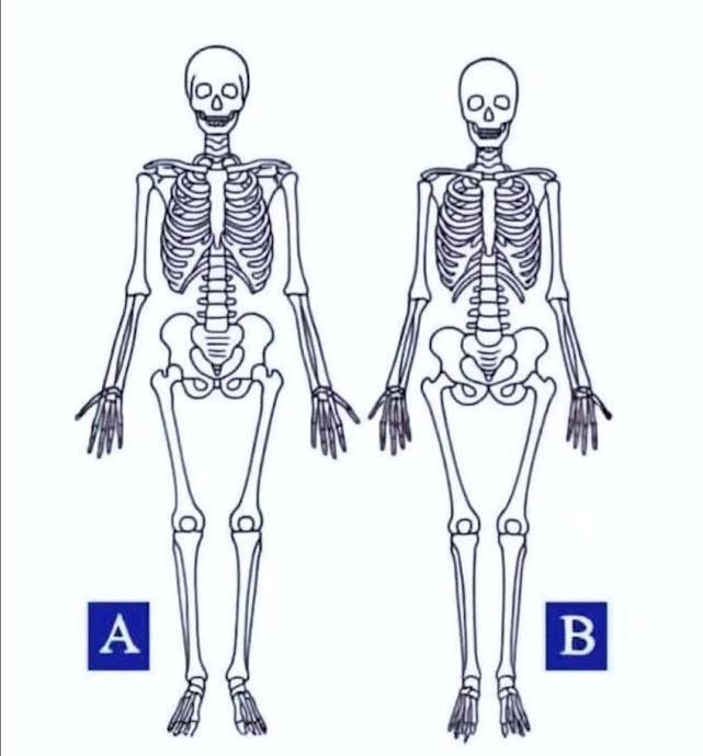 Which one is a woman???