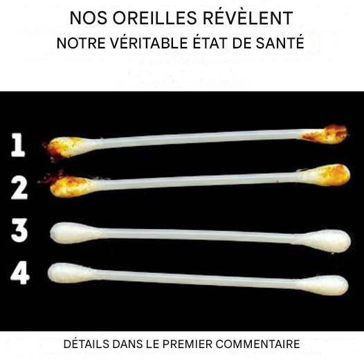 Nos oreilles révèlent le véritable état de notre santé