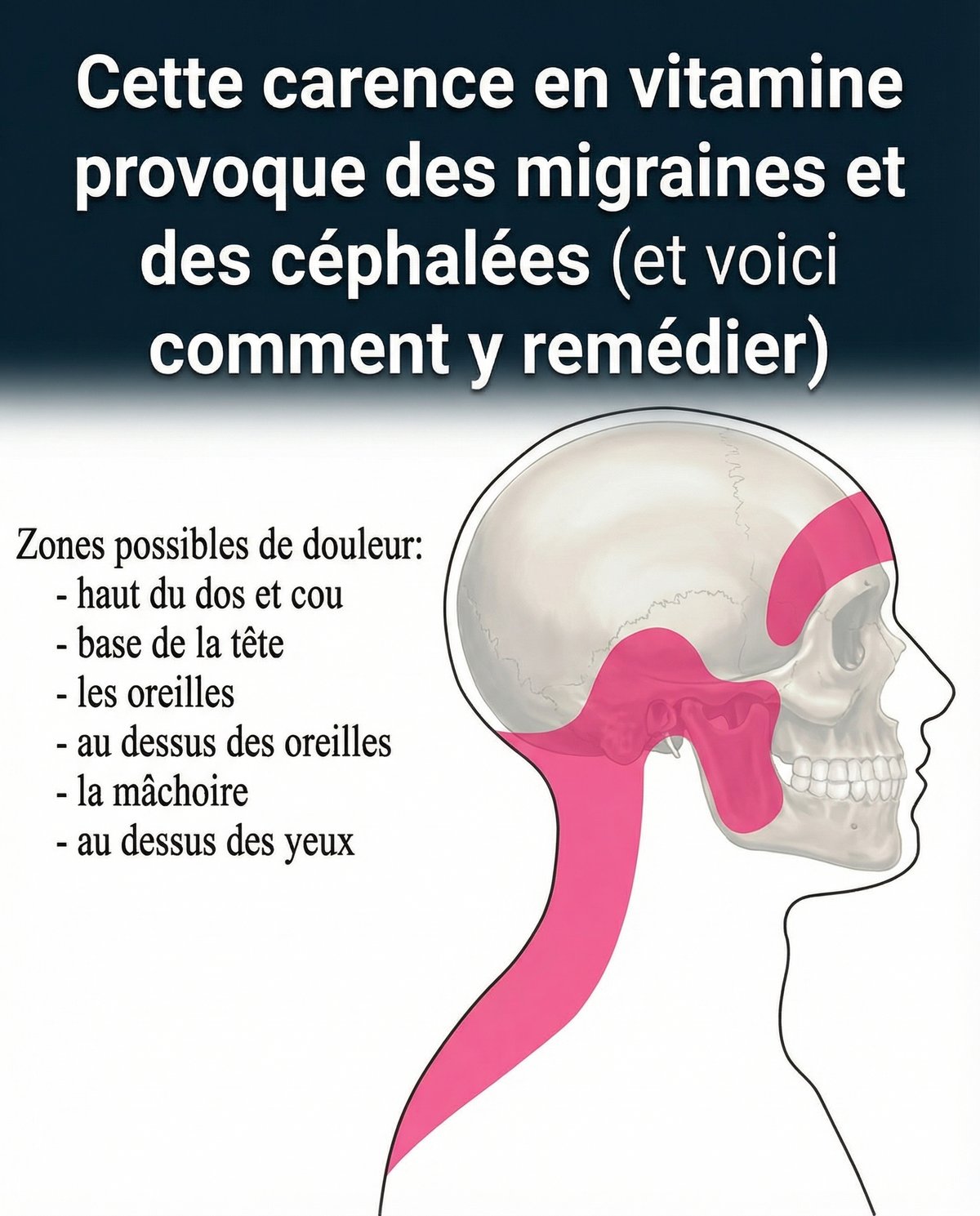 Cette carence en vitamine provoque des migraines et des céphalées (et voici comment y remédier)