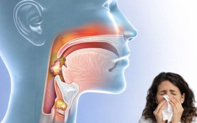 Éliminer le mucus, les glaires dans la gorge et le nez, et la rhinite : remèdes maison