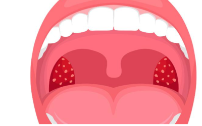 Bouche sèche au réveil : un signe qui pourrait en dire plus sur votre santé que vous ne le pensez.