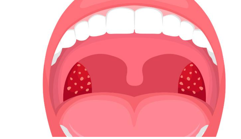 Bouche sèche au réveil : un signe qui pourrait en dire plus sur votre santé que vous ne le pensez.