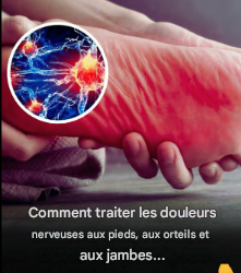 Comment traiter les douleurs nerveuses aux pieds, aux orteils et aux jambes
