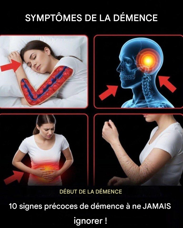 10 signes précoces de démence à ne JAMAIS ignorer !