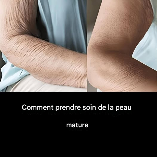 Comment prendre soin d’une peau mature