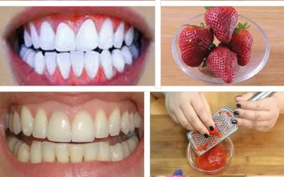 Découvrez une solution naturelle pour blanchir vos dents chez vous