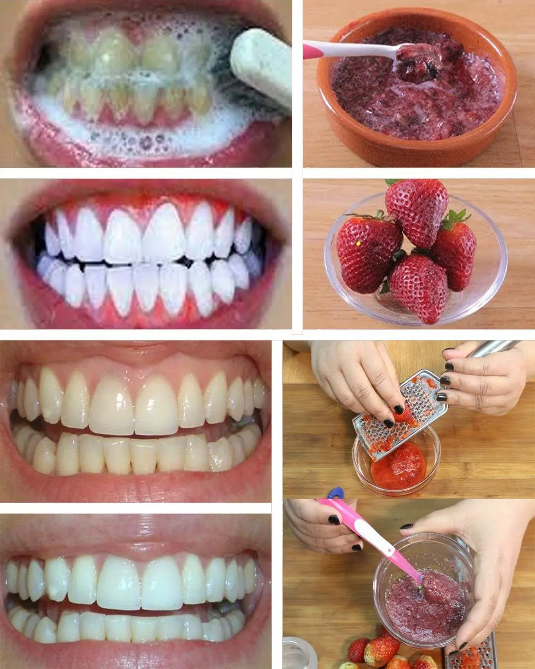 Découvrez une solution naturelle pour blanchir vos dents chez vous