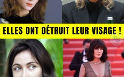 11 Stars Françaises MÉCONNAISSABLES : Le Pire de la Chirurgie Esthétique