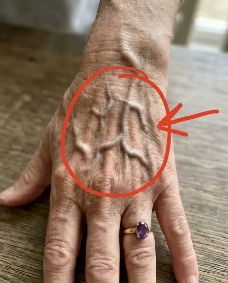 Si vos veines sont visibles, voici ce que cela signifie… En savoir plus