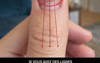 Lignes des ongles : ce qu’elles peuvent révéler sur votre santé