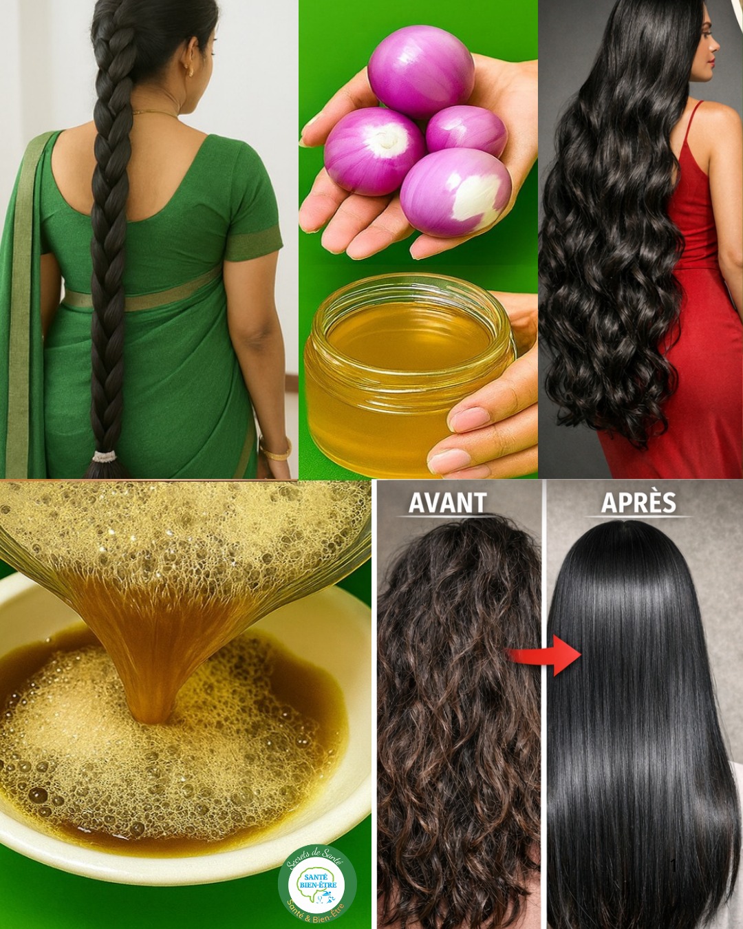 Comment faire de l’huile d’oignon pour que les cheveux poussent plus vite et pour stopper la chute.**Écrivez « OK » dans les commentaires et vous recevrez la recette dans le premier commentaire.** ✍️📩