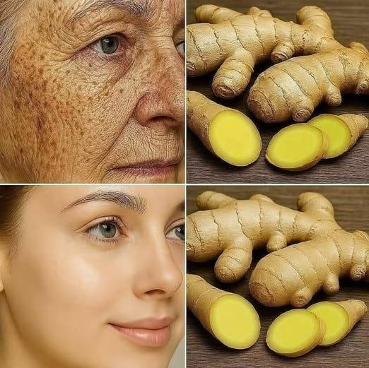 Le gingembre est 100 fois plus efficace que le Botox pour éliminer les rides profondes, les taches de rousseur et les décolorations. Je dois dire quelque chose pour que tu continues à recevoir mes recettes… Merci ! 😍 Recette dans (commentaire)