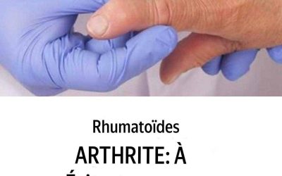 Vivre avec la polyarthrite rhumatoïde : tous les défis du quotidien ?