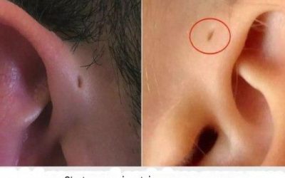 Votre enfant a-t-il un petit trou dans l’oreille ? C’est tellement…