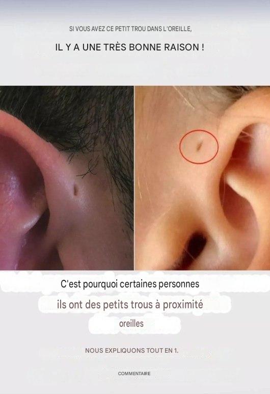 Votre enfant a-t-il un petit trou dans l’oreille ? C’est tellement…