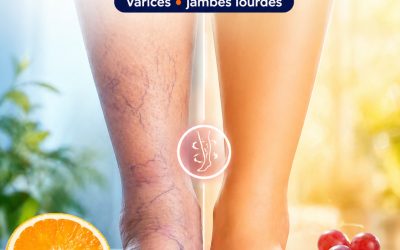 7 fruits incroyables pour combattre la mauvaise circulation, les varices et les douleurs dans les jambes