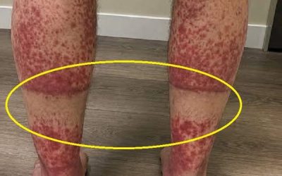 Signes d’alerte sur vos jambes à ne jamais ignorer : comment un environnement de sommeil sûr protège votre santé