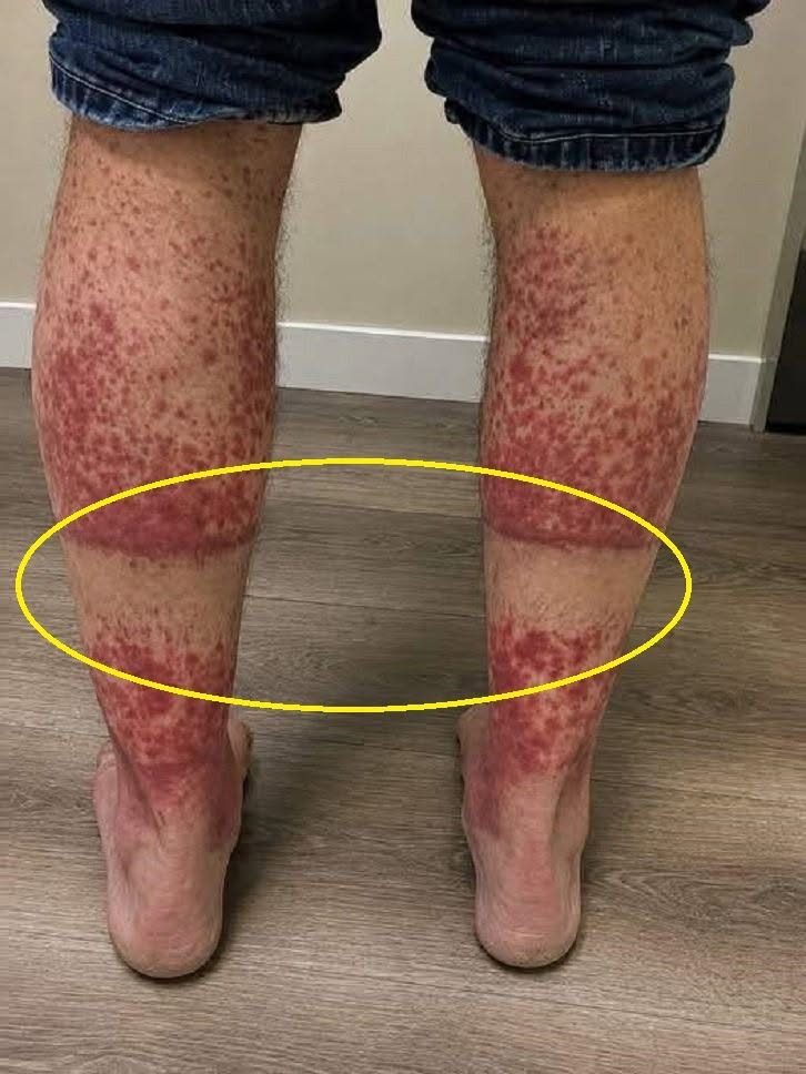 Signes d’alerte sur vos jambes à ne jamais ignorer : comment un environnement de sommeil sûr protège votre santé