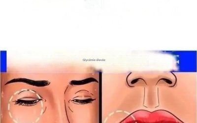 Comment savoir si votre glycémie est trop élevée : 12 symptômes importants et leurs solutions