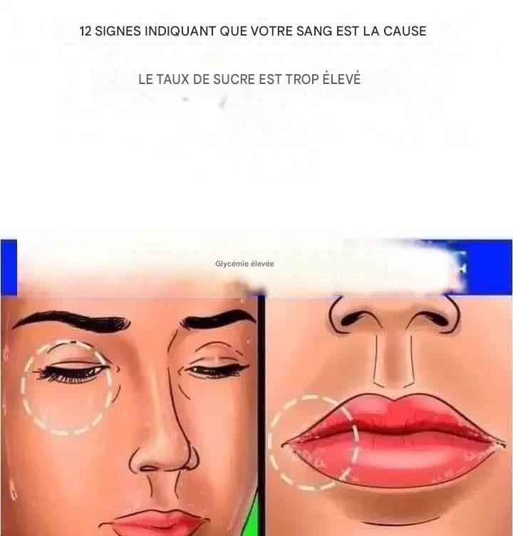 Comment savoir si votre glycémie est trop élevée : 12 symptômes importants et leurs solutions