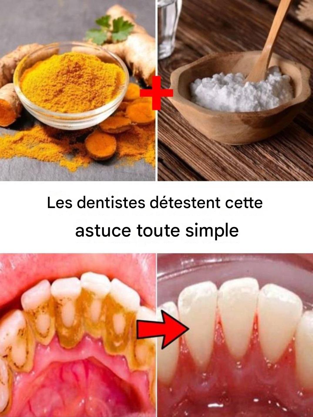 Comment éliminer le tartre et la plaque dentaire sans aller chez le dentiste : curcuma et sel