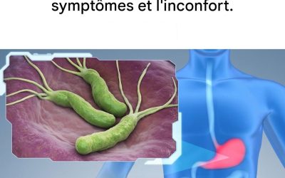 Le meilleur régime alimentaire pour traiter Helicobacter pylori