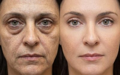Regard fatigué ? L’astuce magique du glaçon revisité pour dégonfler les poches et effacer les cernes en 5 minutes ! 🧊