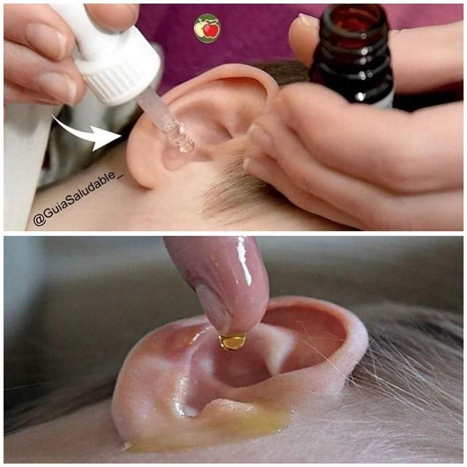Versez 2 gouttes dans votre oreille et vous entendrez à nouveau à mesure que votre audition se rétablira avant.
