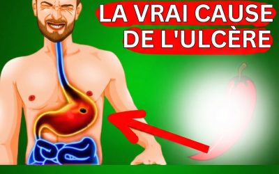 Comment guérir les ulcères d’estomac naturellement : 4 aliments essentiels à inclure dans votre alimentation