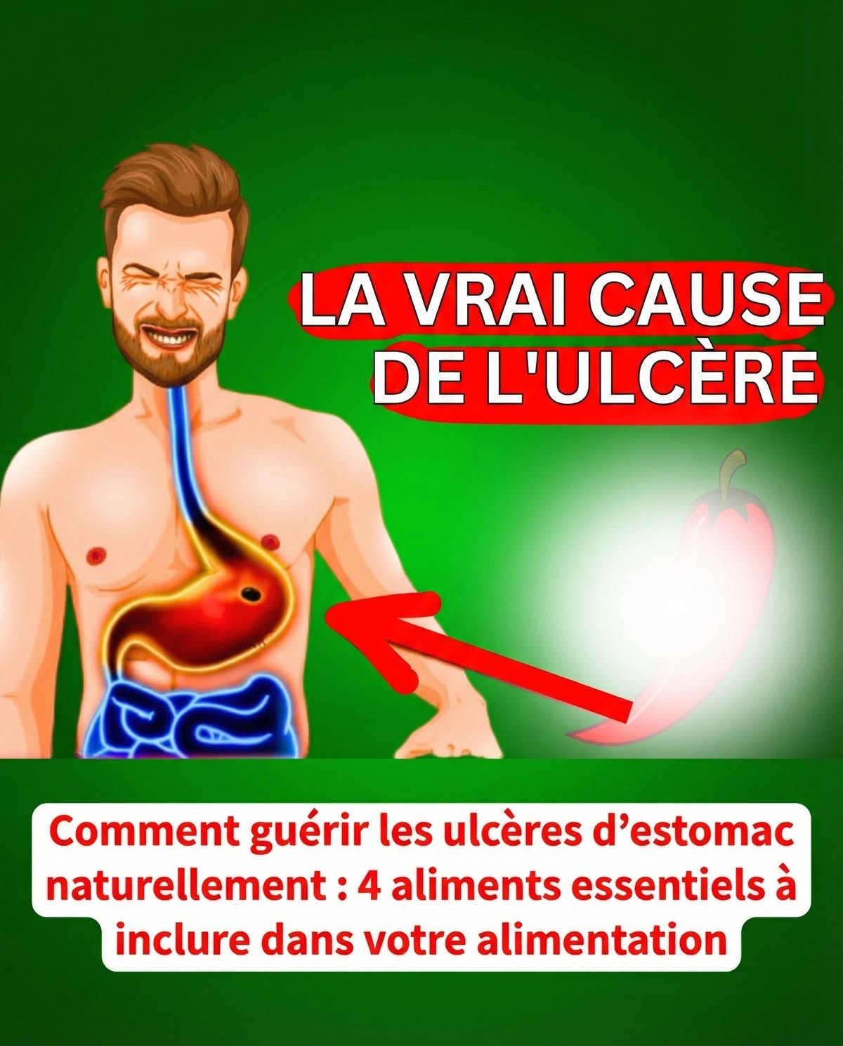 Comment guérir les ulcères d’estomac naturellement : 4 aliments essentiels à inclure dans votre alimentation