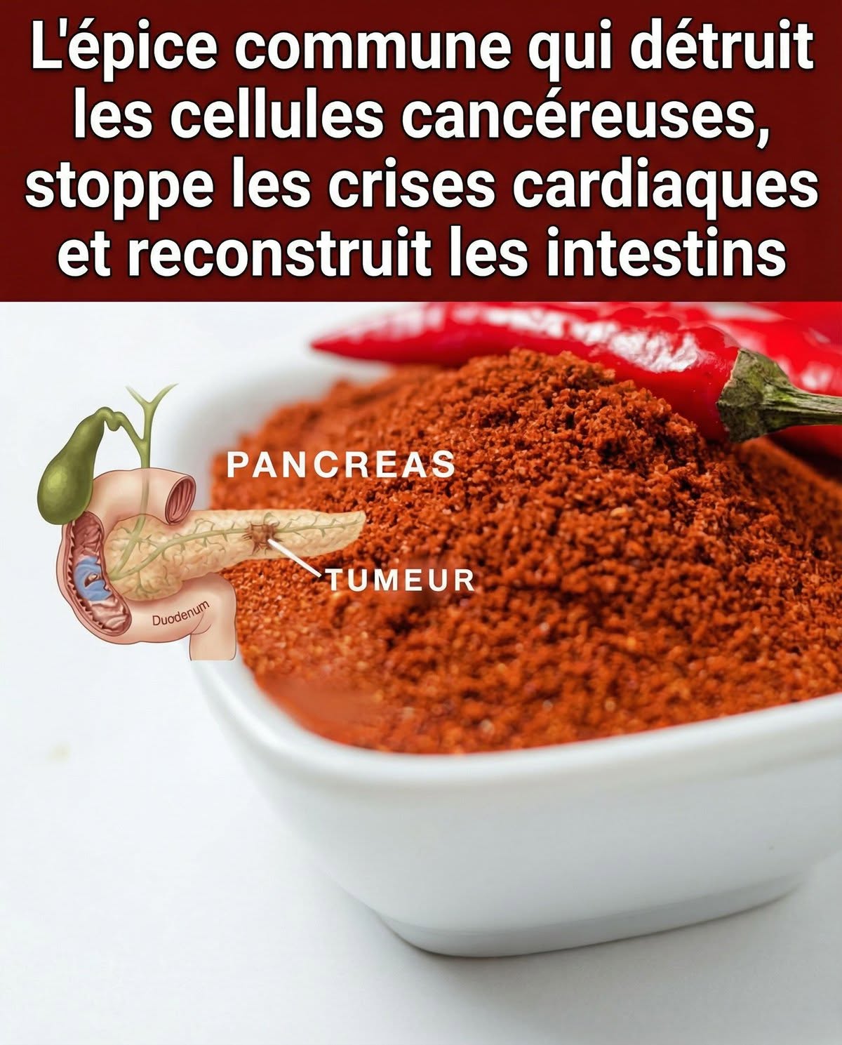 L’épice commune qui détruit les cellules cancéreuses, stoppe les crises cardiaques et reconstruit les intestins