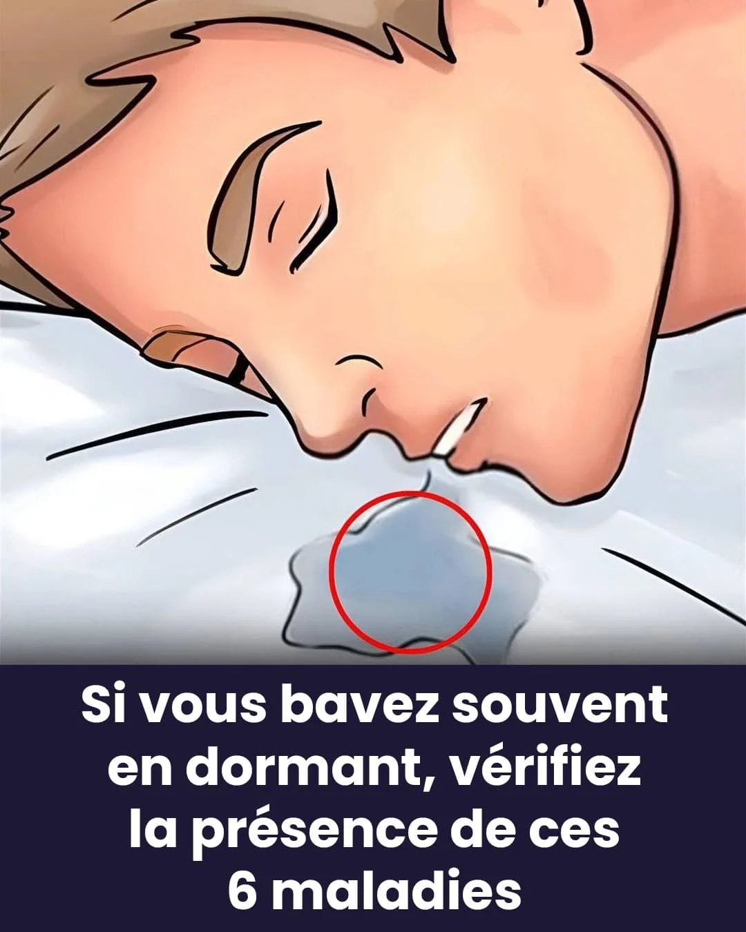 Révélation nocturne : pourquoi votre bouche coule-t-elle pendant votre sommeil ?