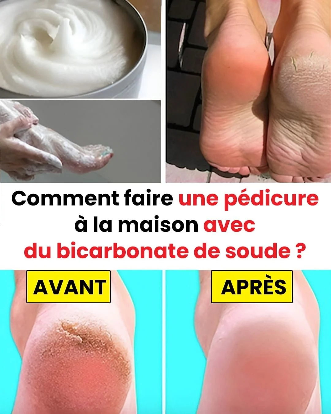 Offrez-vous une pédicure digne d’un spa avec un ingrédient de cuisine : le bicarbonate de soude.
