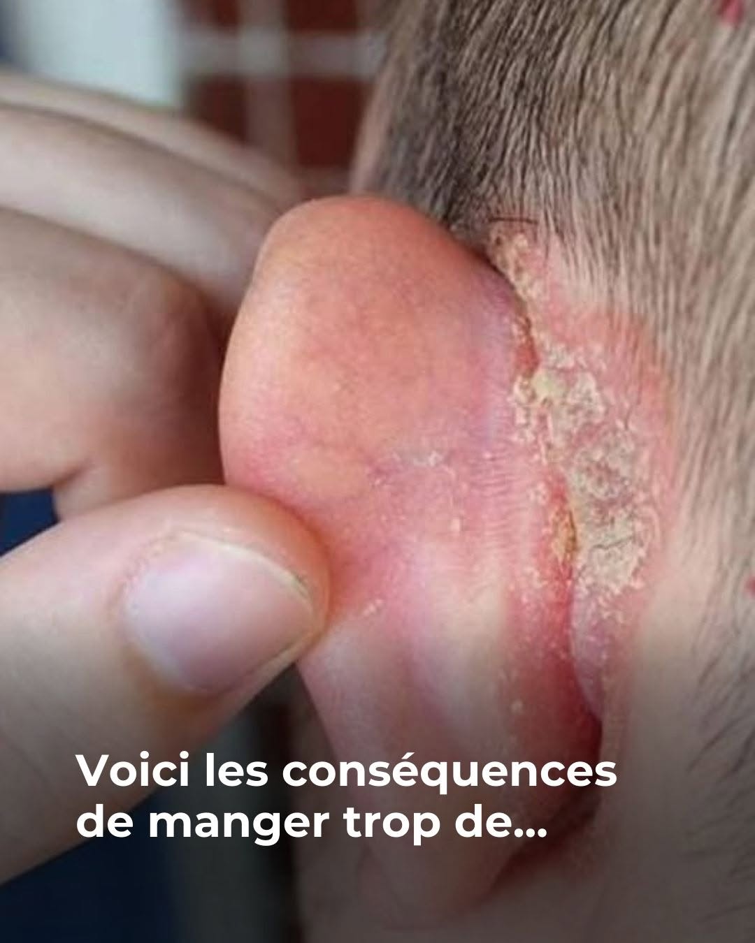 Voici les conséquences de manger trop de…Voir plus