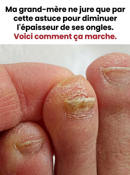 L’astuce oubliée des aînés pour affiner naturellement les ongles des orteils