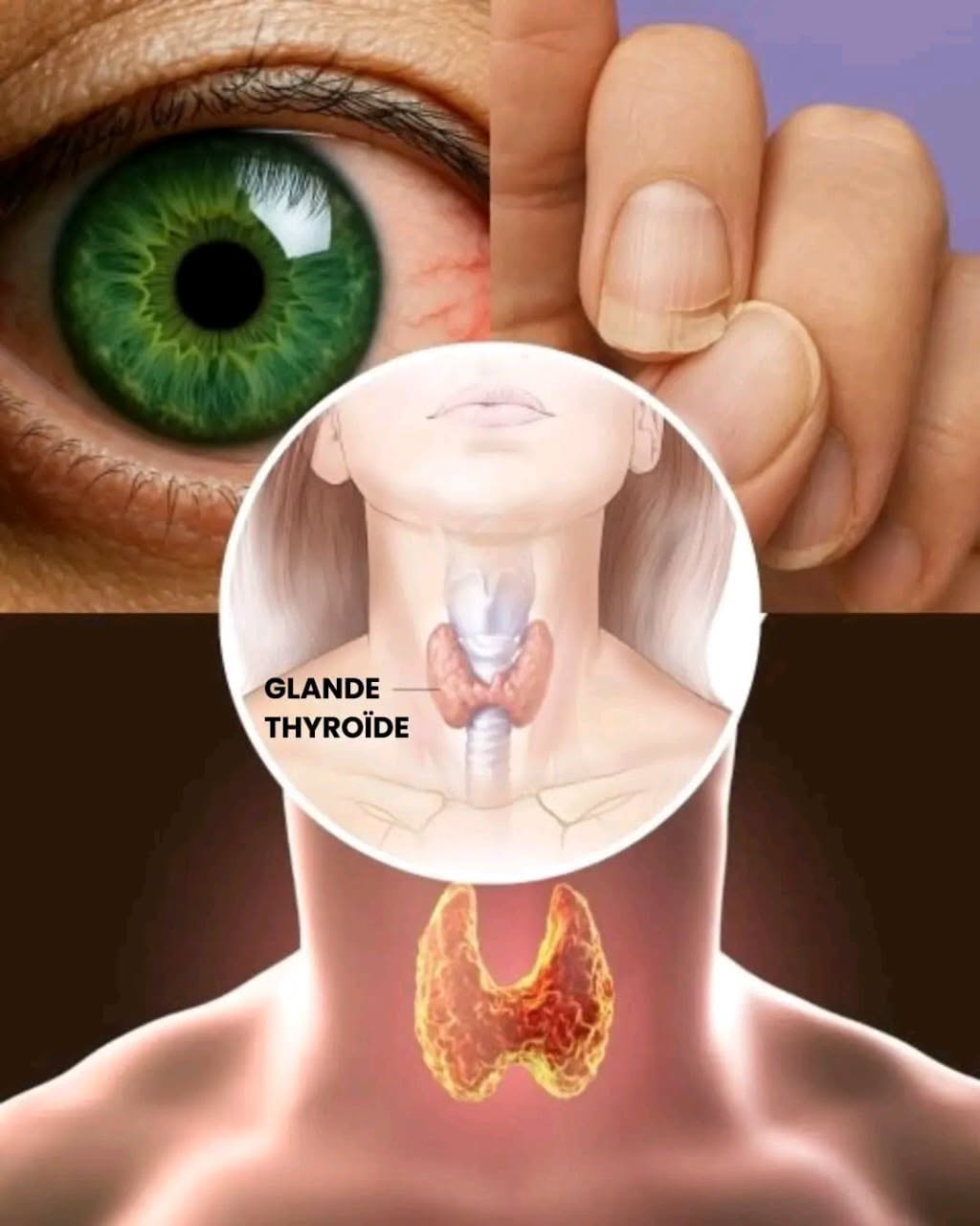 10 signaux cachés indiquant que votre thyroïde ne fonctionne pas correctement««