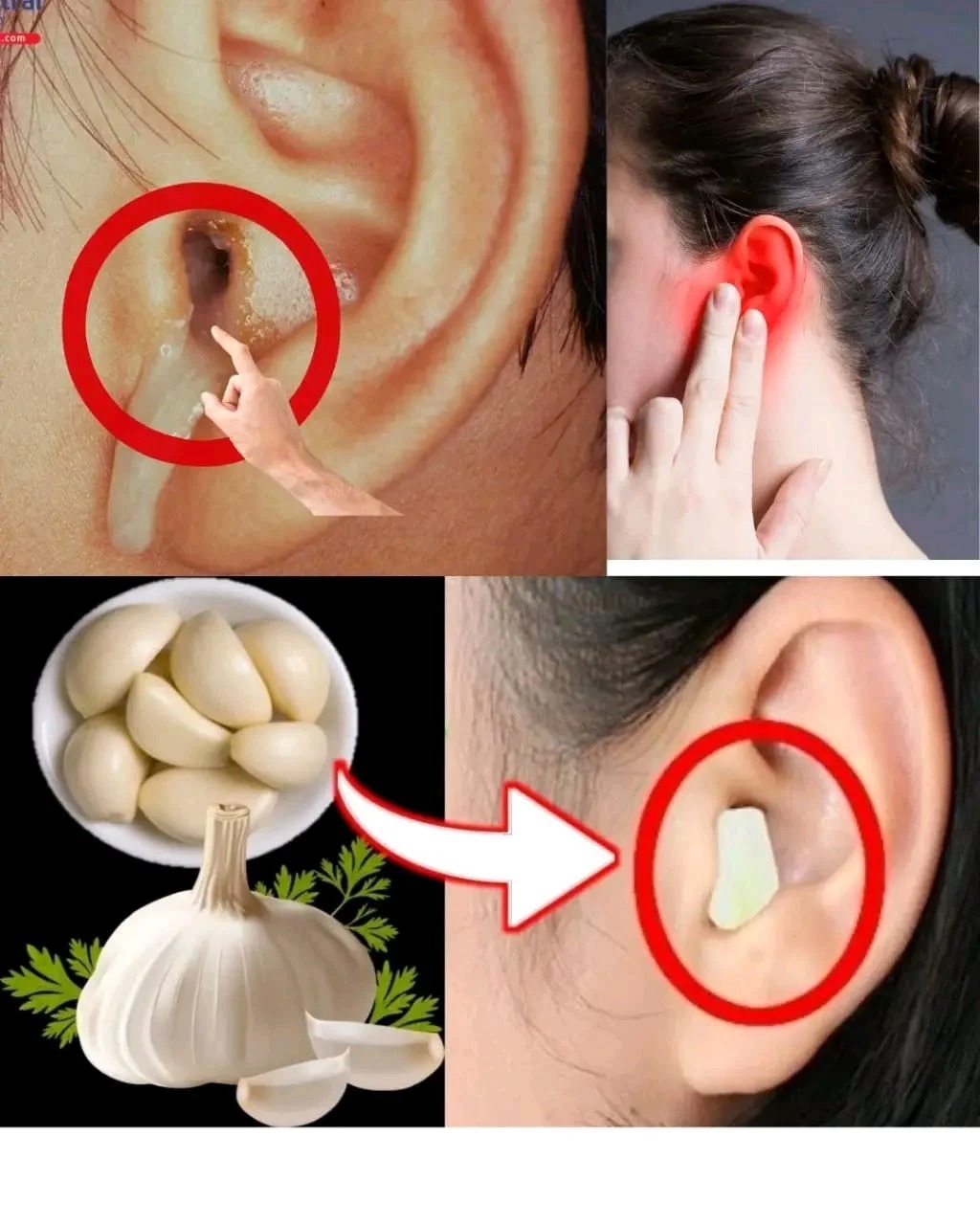 L’ail pour la santé des oreilles : soulagement et protection naturels..?