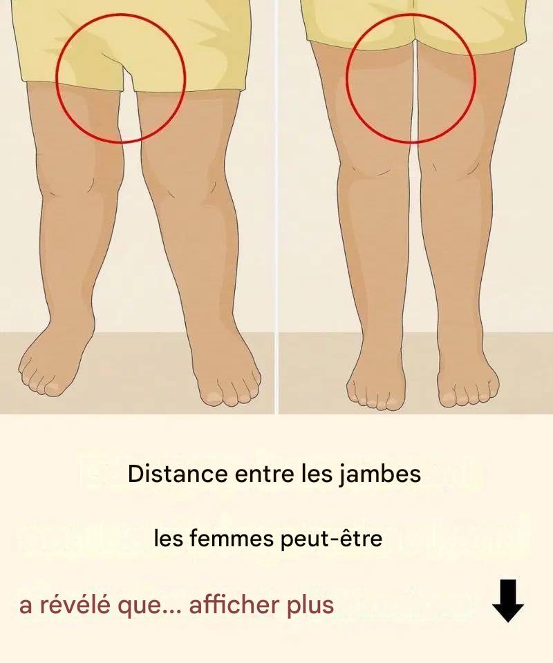 Pourquoi les morphologies ne devraient pas être jugées selon les tendances